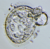 SCNT 1 thumbnail image